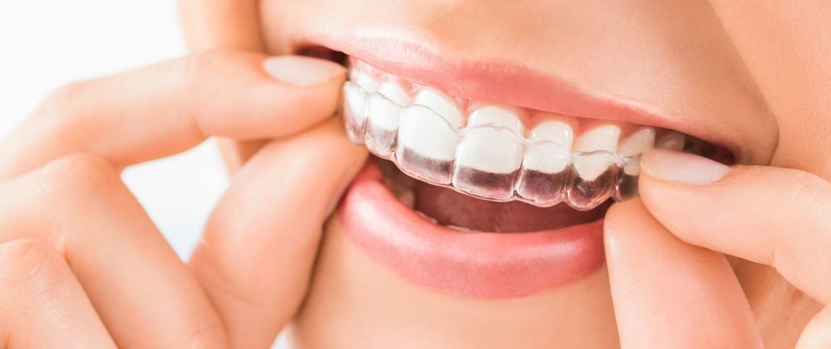 bite denti